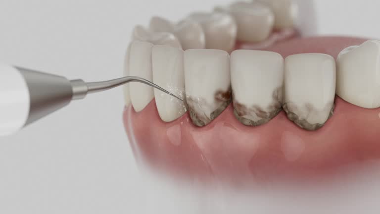 Reliable Root Canal Treatment contractor in Van Buren County County, AR by Dentist Open Now
